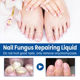 Nail Repairing Liquid, Nails Fast Effective Grey Nail Repair Liquid for Toenail Fingernails, Protects Thick, Broken And Discolored Nails, Fix Renew Damaged for Toenail and Fingernail