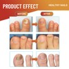 32 PATCHES Fungal Nail Patches - Nail Fungus for Toenail