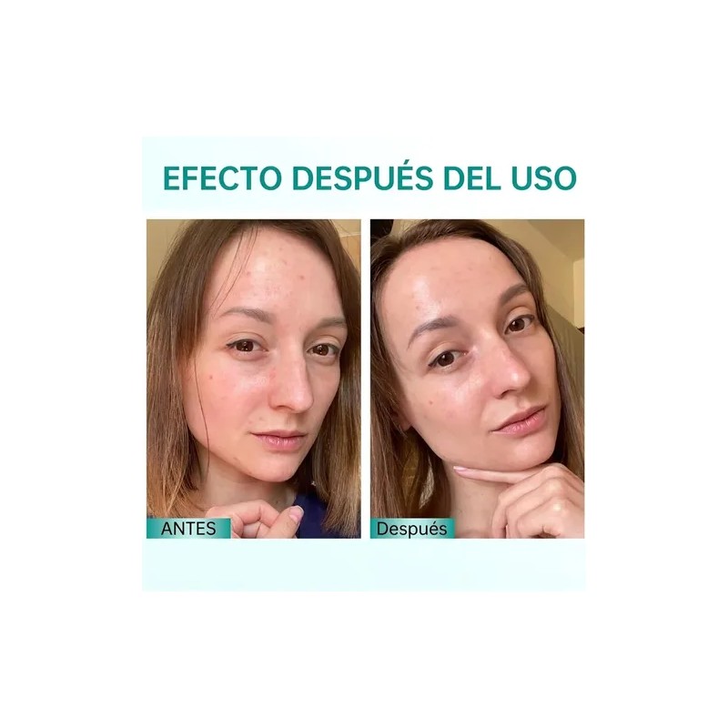 2pz *60ml Pdrn Crema Hidratante Facial Con Acido Hialurónico