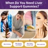 Milk Thistle Gummies with 2000MG Extract, Liver Health Support Gummies,