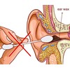 Remos ear cleaner for hygienic removal of earwax