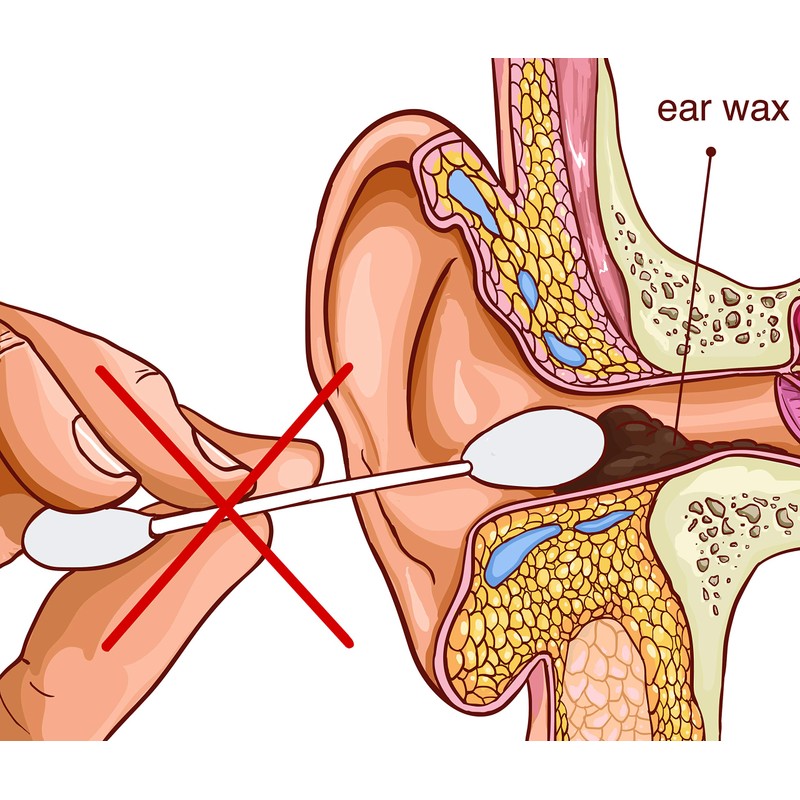 Remos ear cleaner for hygienic removal of earwax