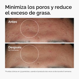 The Ordinary Niacinamide 10% + Zinc 1%, Suero para Imperfecciones con Niacinamida — Suero que unifica el tono, suaviza e ilumina. Ideal para pieles con tendencia a los brotes, 30ml