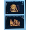 Prank 3D COLOR Customized Fake Ultrasound Strip of 2 Photos