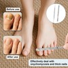 Menibeuty Be-Zox, 2pcs Lange Nagelfeile Professionellezehennägel Doppelinstrument Eckenheber Fuß-Pflege, Für
