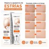 Crema Para Estrías Eliminar Las Estrías Del Embarazo