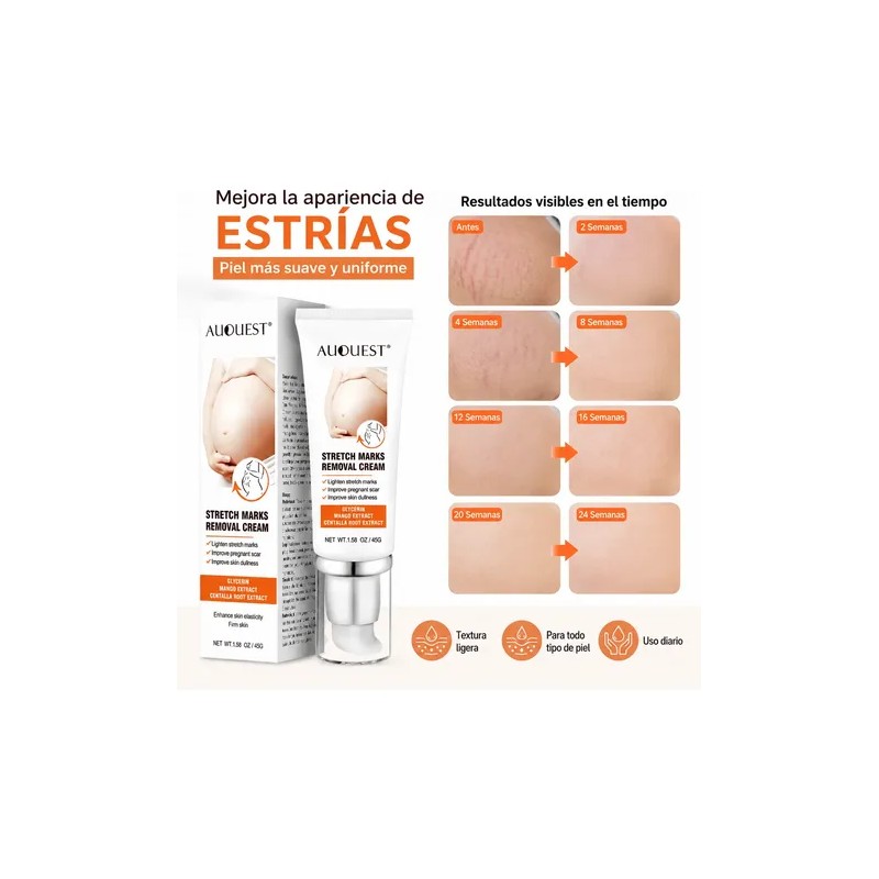 Crema Para Estrías Eliminar Las Estrías Del Embarazo