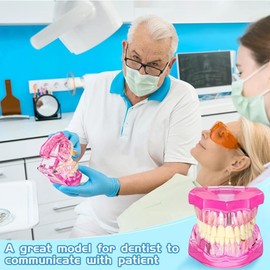 Binxind Disease Teeth Model Dental Typodonts Implant Teeth Model with Removable Teeth Pathological Demonstration (Pink,2 Pcs)