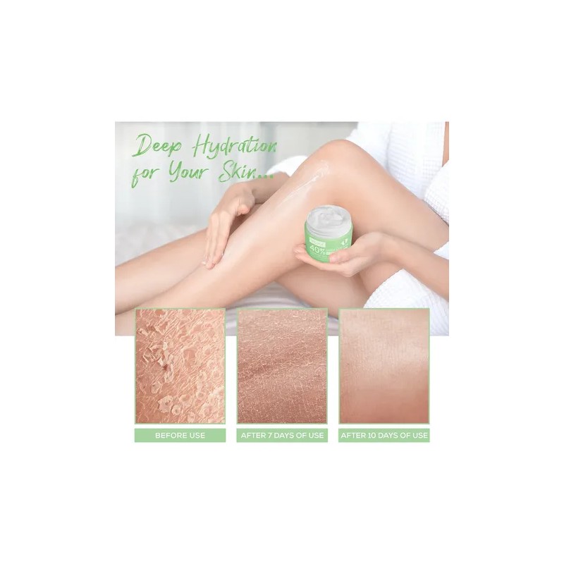 Crema Hidratante Absorción Rápida Úrea 40% Vegana Corporal
