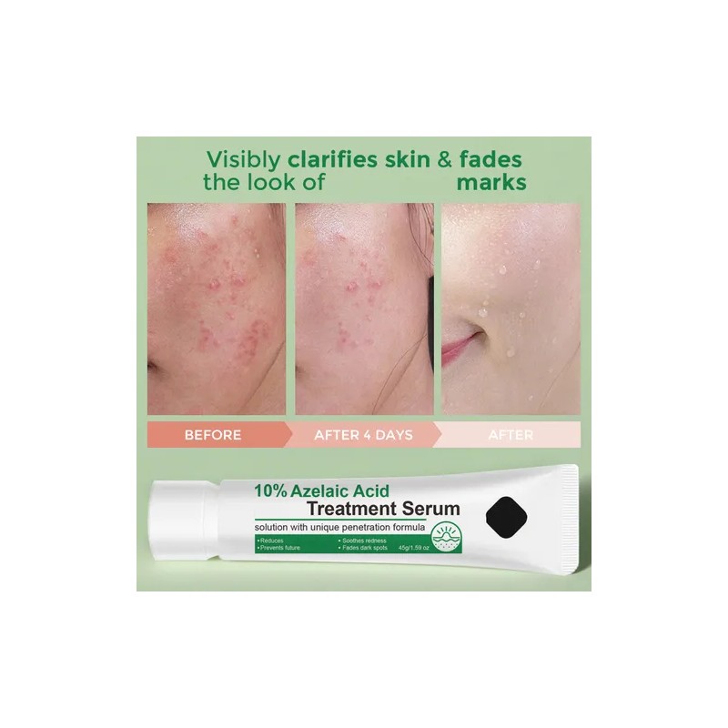 Srum Facial Azelaic 12 45 G Para El Cuidado De