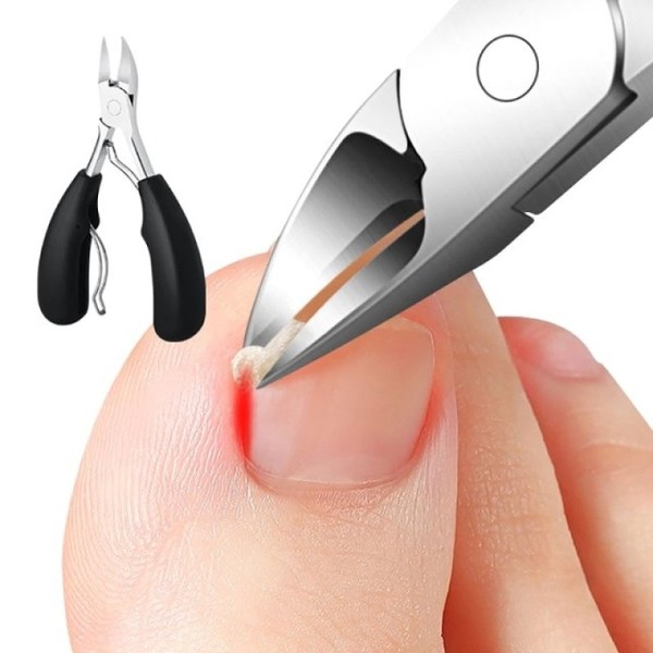 Sharp pointed nail/toenail clippers (single item) / 뾰족 매부리 예리한