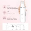 Limpiador Facial Ultrasónico Exfoliante Espinillas Belleza Blanco