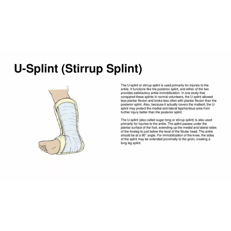 OrthoTape Fiberglass Stirrup Sprained Ankle Splint Kit | Materials make