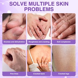 Hand Cream for Dry Skin Relieves and Repairs Extremely Dry Hands