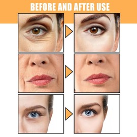 Vitamin C Face Serum Stick,Vitamin C Eye Cream,Eye Balm Stick,Brightening & Hydrating Serum For Face & Body,Facial Serum Balm Stick For Fine Lines & Wrinkles,Lightweight Light For Smooth Skin