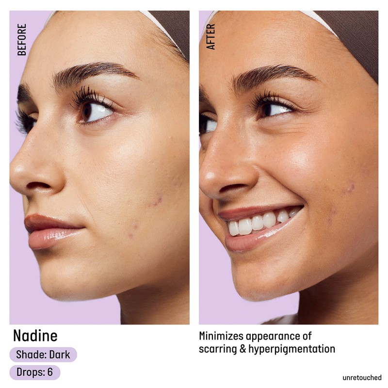 Isle of Paradise Face & Body Self-Tanning Drops, Dark (10ml)