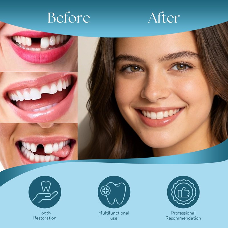 DIY Denture Kit, Temporary Full set of Dentures, DIY Full