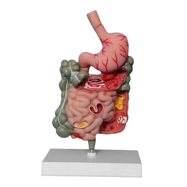 F Fityle Human Digestive System Model,Stomach Section PVC Sturdy Scientific