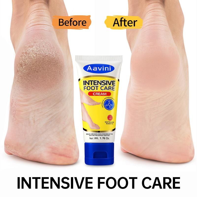 Aavini Intense Foot Cream - Repairs Cracked Skin, Antibacterial and