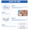 Anti Snoring Splint Snoring Splint Crunch Splint Against Teeth Grinding