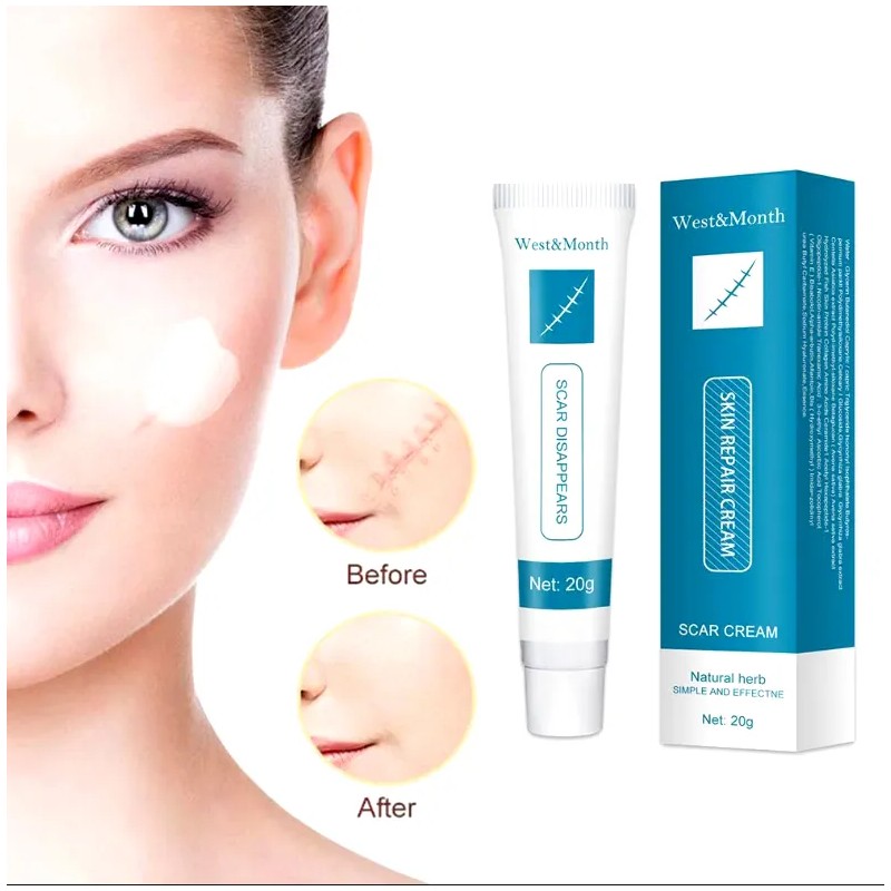 Crema Reparadora Para Cicatrices De Acné Y Estrías 20g Mixta