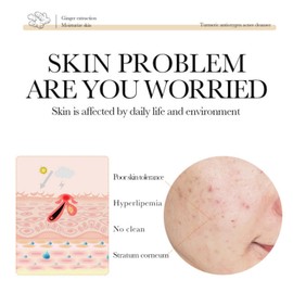 Turmeric Face Wash - Face Cleanser - Turmeric Foaming Cleanser - Brightening Turmeric Facial Cleanser - Deep Cleansing Of Facial Skin - Moisturizing Face Care for Women&Men 100ml