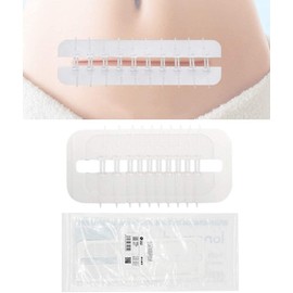 Mediss Emergency Wound Closures Band-Aid Adhesive Bandages, Zip Stitch Stickers Device After Caesarean Birth, Injury, Survival (1 Pcs x Individually Wrapped)