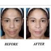 Melasma, Hiperpigmentación Piel Oscura, Manchas,frasco 50 Ml