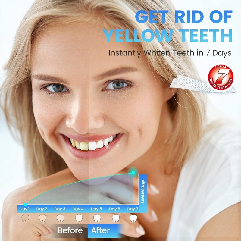 5D White Teeth Whitening Strips, 14 Treatment for Teeth Whitening,