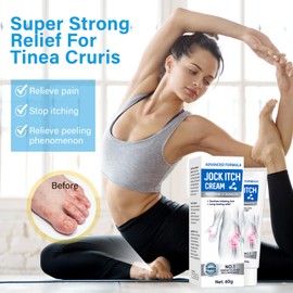Jock Itch Cream, Jock Itch, Jock Itch Cream Extra Strength for Men & Women,Tinea Cruris, Tinea Corporis, Itch Cream - Powerful & Fast - 60g