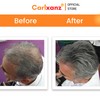 Carlxanz Hair Fiber Classic (4 x 25g)
