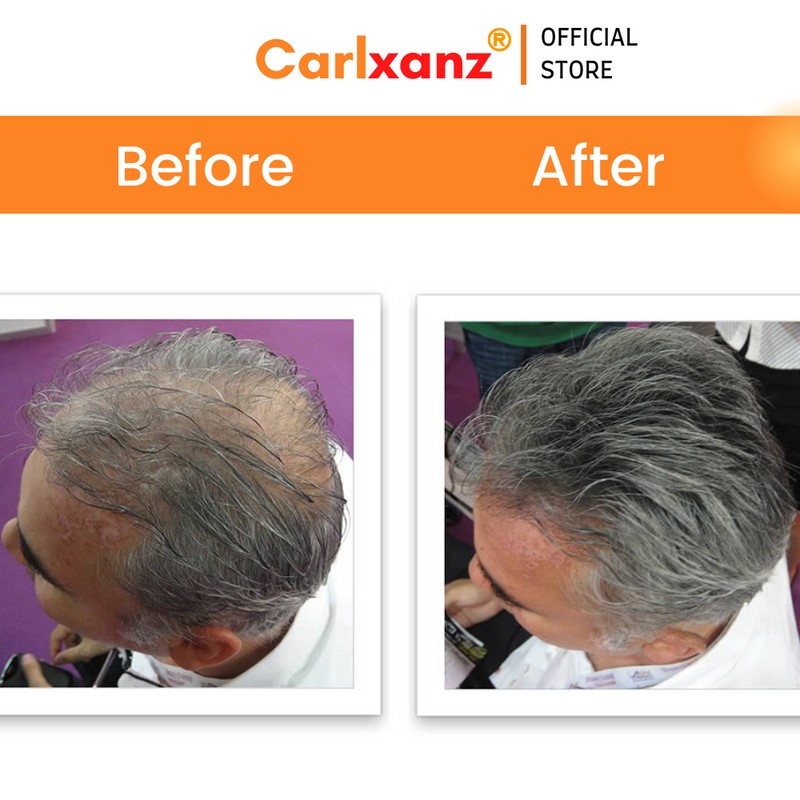 Carlxanz Hair Fiber Classic (4 x 25g)