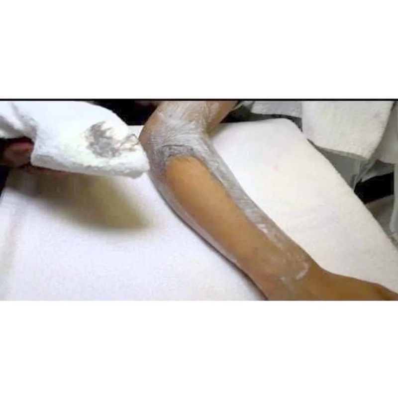 Crema Depilatoria Remove Depilacion Zona Genital 220 Grs