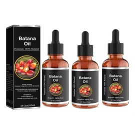 Aceite De Batana,tratamiento De Pérdida De Cabello 60ml