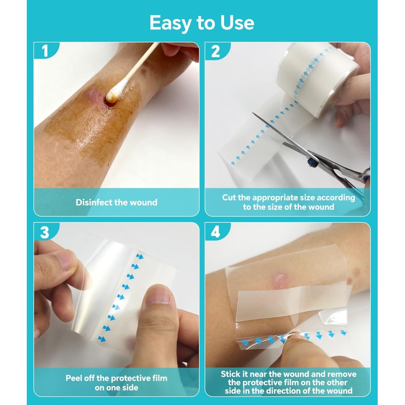 2026 Upgrade Hydrocolloid Roll for Wound Care, 2in*16.4ft Cuttable Hydrocolloid