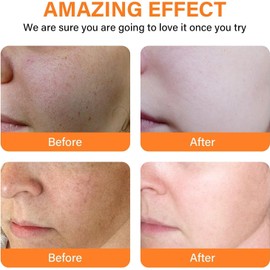 Vitamina C 20% + Vitamina E – Antioxidante, Antimanchas, Antiarrugas y Ácido Hialurónico para una Piel Hidratada, Lisa y Uniforme (1PC)