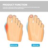 Uonlytech 32 Separadores De Dedos De Silicona Para Pedicura Divisores