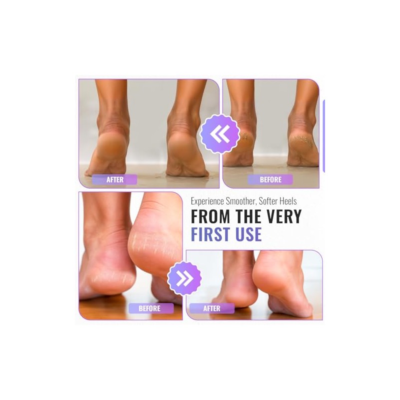 TYGA Foot Rasp and Foot File, Wet & Dry Use,