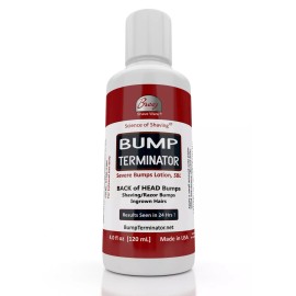 Bump Terminator Severe Bumps Lotion - Shaving Bump Ingrown Hair Treatment-Unis<wbr/>ex