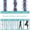 Medias de compresión médicas para mujeres y hombres, 20-30 mmHg,