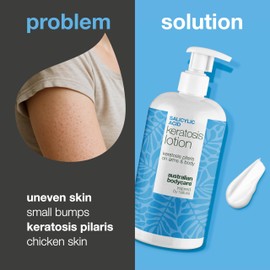 Keratosis Pilaris Body Lotion – Smooths Bumpy Skin, Chicken Skin & Strawberry Legs – Keratosis Pilaris Treatment with Salicylic Acid, Niacinamide & Zinc