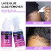 MATEPLEX Lace Wig Glue + Glue Remover Kit for Front