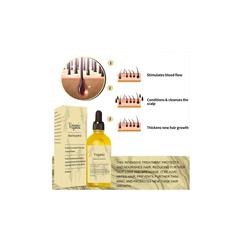 Aceite Para El Crecimiento Del Cabello Kisinly Veganic Rosem