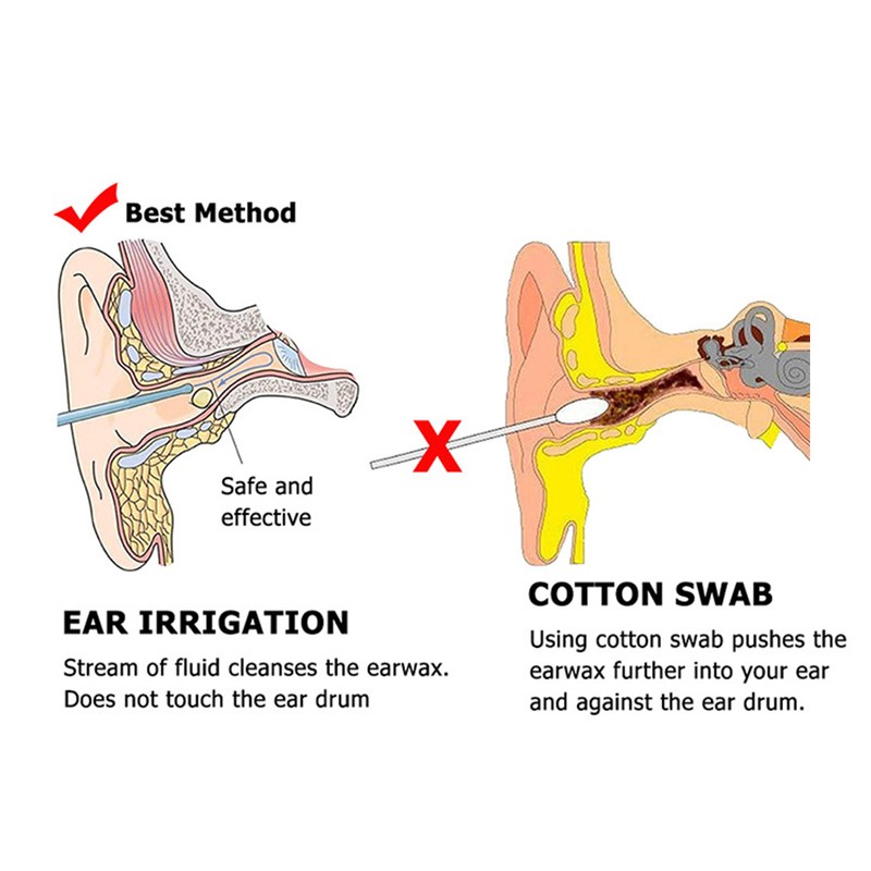 Ear Wax Removal Tool Kit Ear Wax Remover Washer Bottle