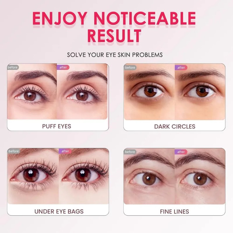 Parches Para Debajo De Los Ojos Para Mujeres: Mascarillas Pa