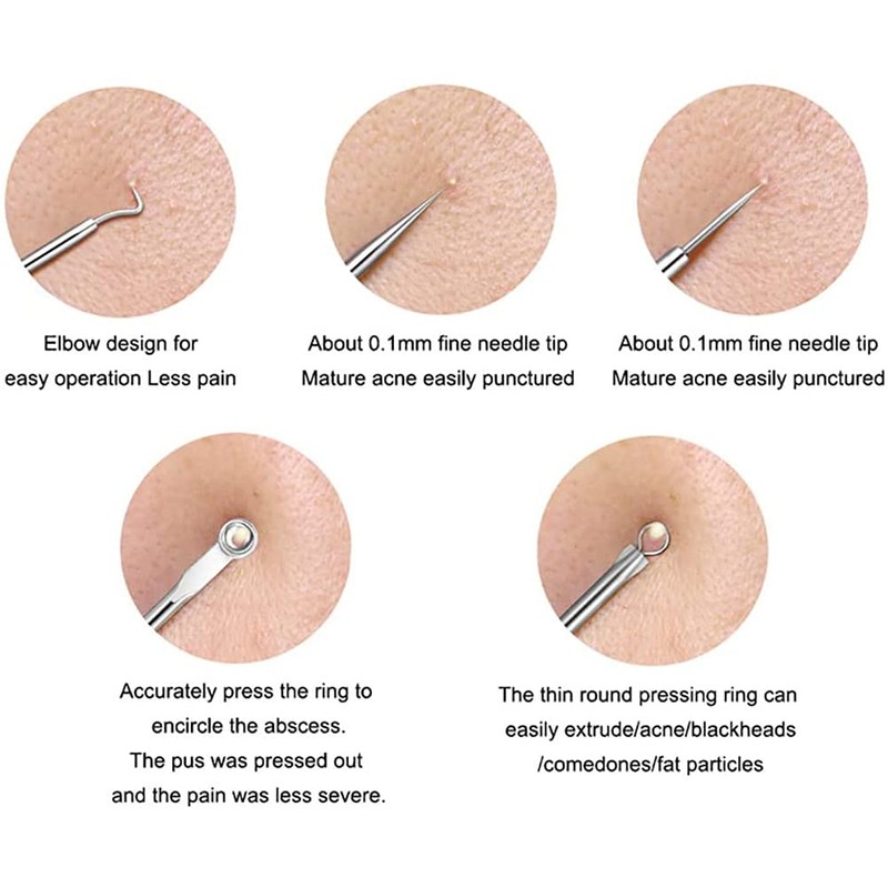 Blackhead Removal Kit, Blackhead Remover, 4 Piece Set with Storage