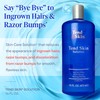 Tend Skin Solution for Unsightly Razor Bumps, Ingrown Hair and