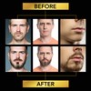 Beard Growth Kit, with Beard Roller, Beard Growth Serum Oil,