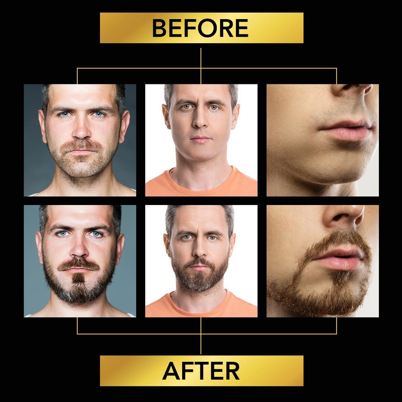 Beard Growth Kit, with Beard Roller, Beard Growth Serum Oil,