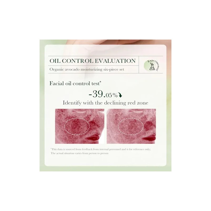 Kit Skincare Aguacate 7pz Tonico Suero Limpiador Balsamo Loc